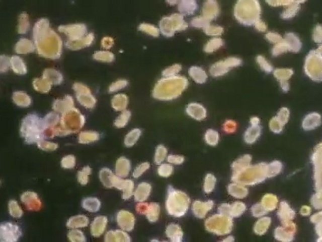 L’aventure antibiotique – La naissance d’un empire