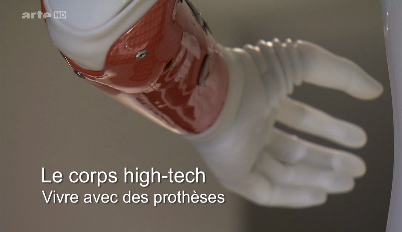 Documentaire Le corps high-tech : vivre avec des prothèses