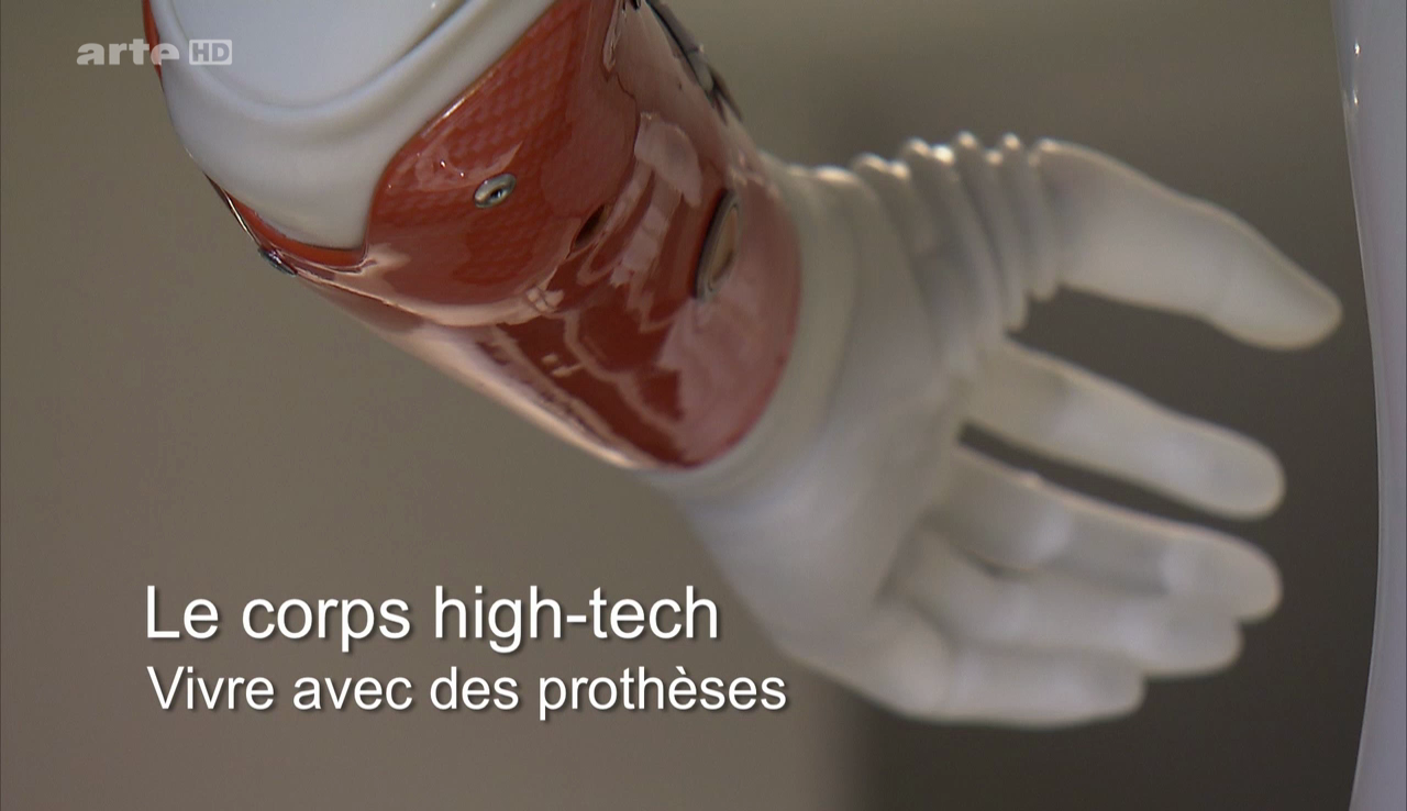 Le corps high-tech : vivre avec des prothèses