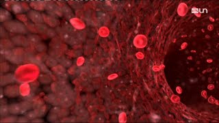 Reconnaître un infarctus et faire les gestes qui sauvent