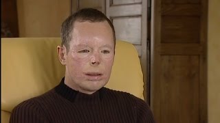 L'Homme dévisagé