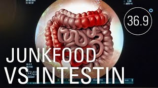Documentaire SOS maladies inflammatoires de l’intestin