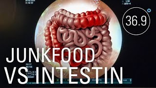 SOS maladies inflammatoires de l’intestin