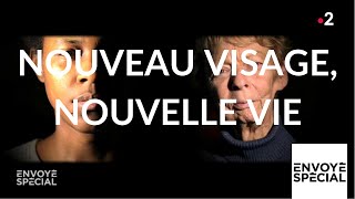Nouveau visage, nouvelle vie