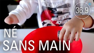 Le mystère des enfants nés sans main ou bras