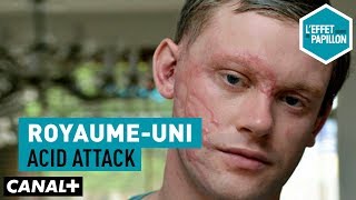 Royaume-Uni : acid attack