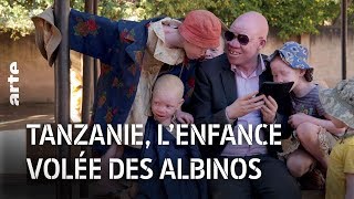Tanzanie : l'enfance volée des albinos