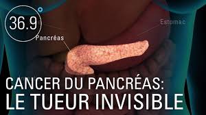 Cancer du pancréas : le tueur invisible