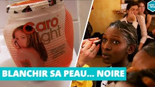 Blanchir sa peau noire à tout prix