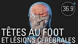 Documentaire Têtes au foot et lésions cérébrales