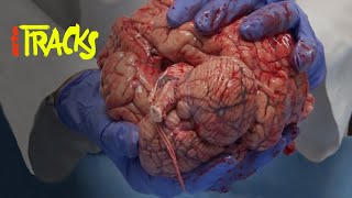 Neurodroits : comment protéger nos pensées ?