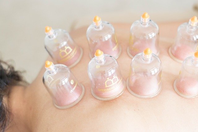 Découvrez la cupping thérapie
