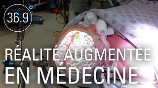 Réalité augmentée en médecine