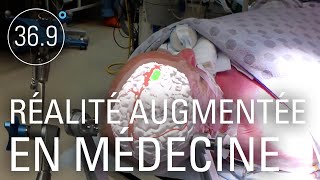 Documentaire Réalité augmentée en médecine