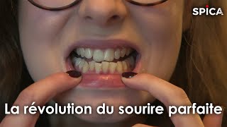 La révolution du sourire parfait
