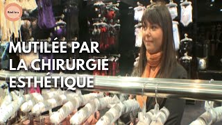 J'ai été victime de la chirurgie esthétique à 24 ans I Partie 1