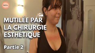 Documentaire J’ai été victime de la chirurgie esthétique à 24 ans I Partie 2