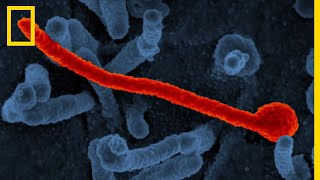 Tout comprendre sur Ebola