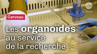 Organoïdes : des cerveaux de laboratoire pour la recherche