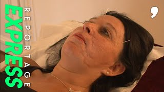 L'acupuncture est-elle vraiment efficace ?