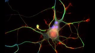 Matière grise ? Alignement et géométrie des neurones