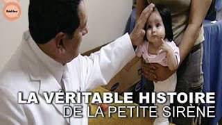Documentaire L’incroyable Histoire du bébé sirène: une Saga médicale qui a ému une nation entière