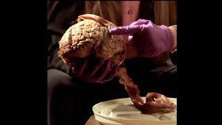 Un voyage dans notre cerveau