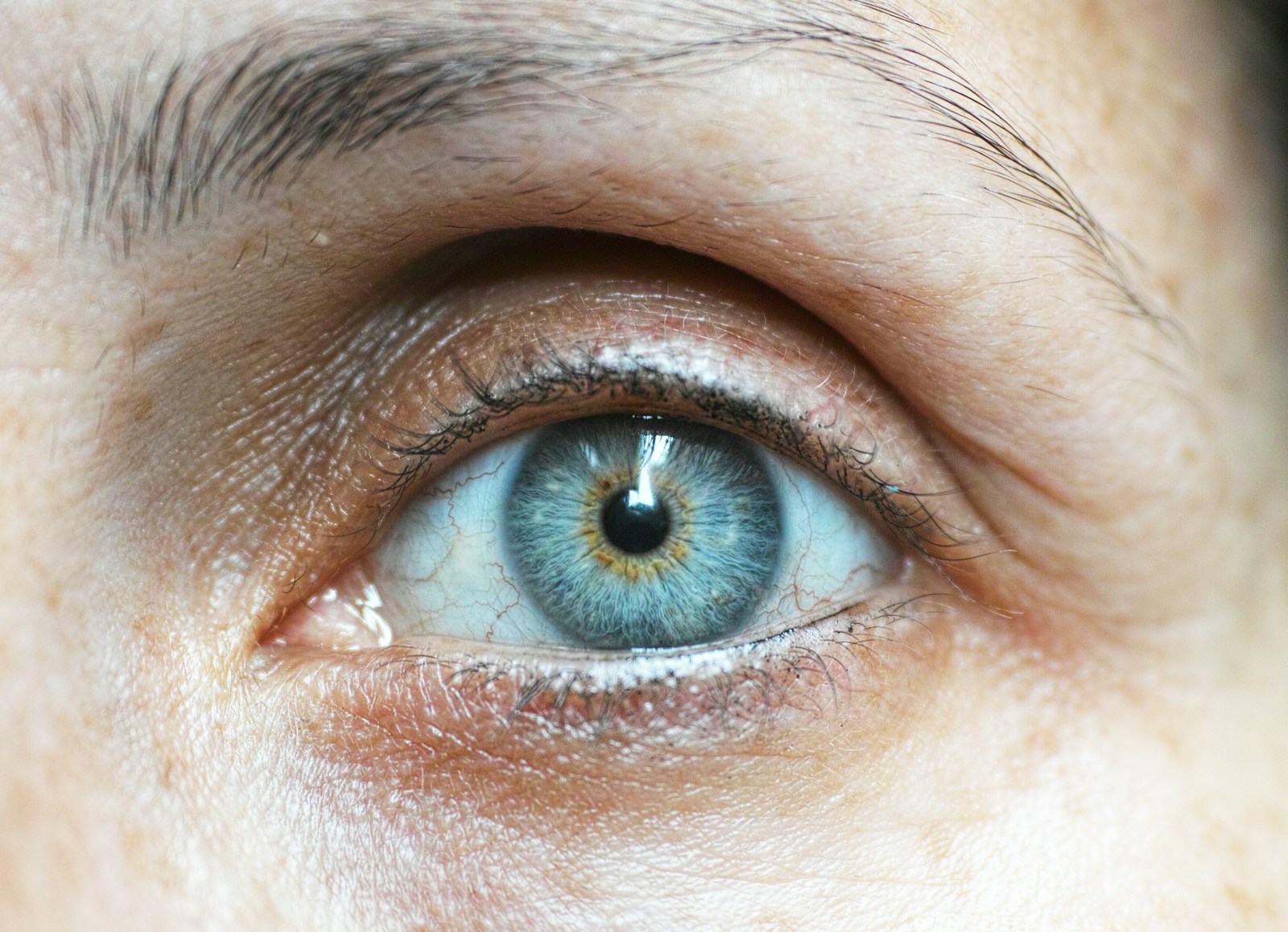 Poches sous les yeux : comment s&rsquo;en d&eacute;barrasser ?
