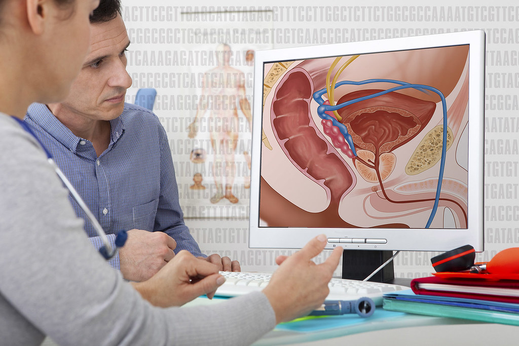 Le manque d'exercice physique est un autre facteur de risque pour la santé de la prostate.