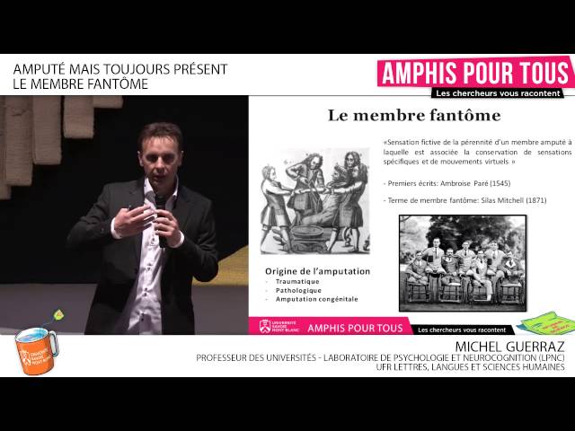 Amputé mais toujours présent, le membre fantôme