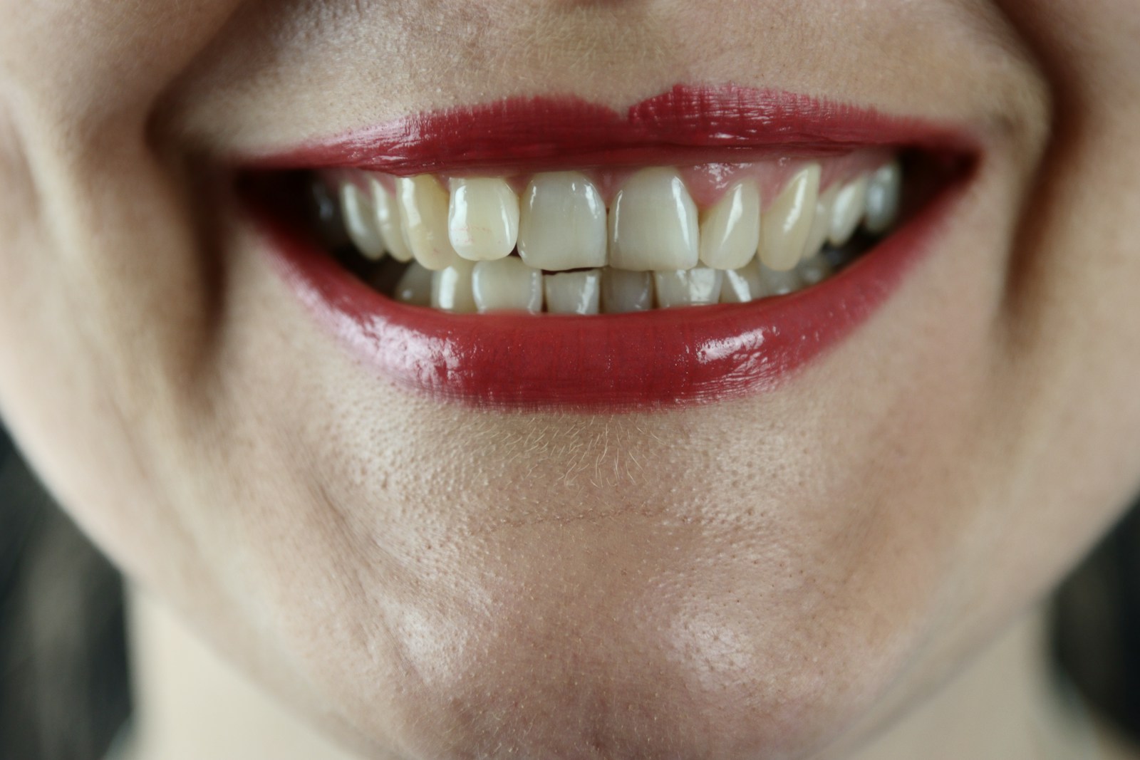 Pourquoi vos dents perdent leur éclat ?