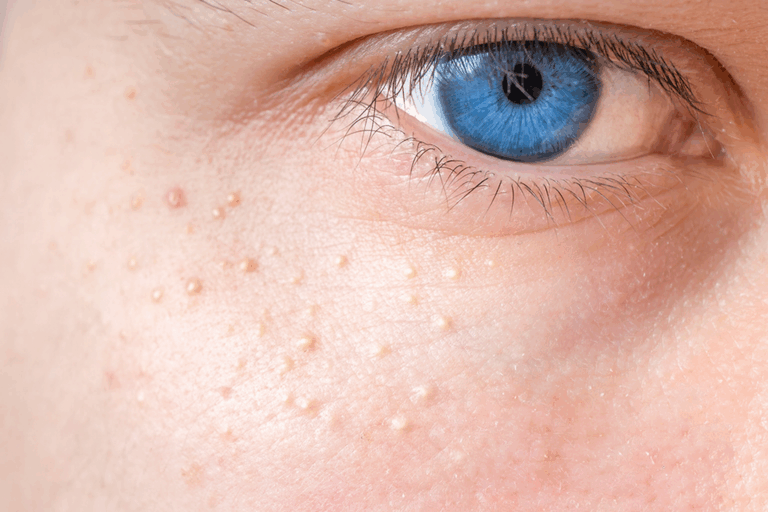 Article | C’est quoi, les grains de milium ?