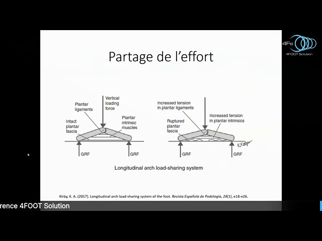 Muscles intrinsèques du pied et pathologies de compression