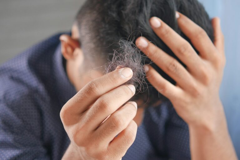 Article | Chute de cheveux : quels remèdes fonctionnent vraiment ?