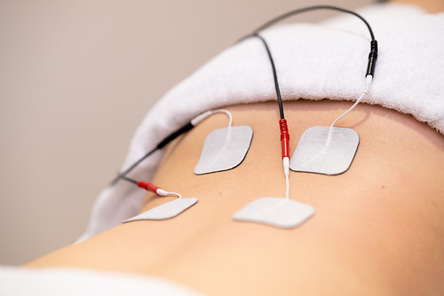 Article | L’électrostimulation : une méthode vraiment efficace pour développer sa musculature ?
