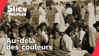 Couleur de peau : ce que la science révèle enfin