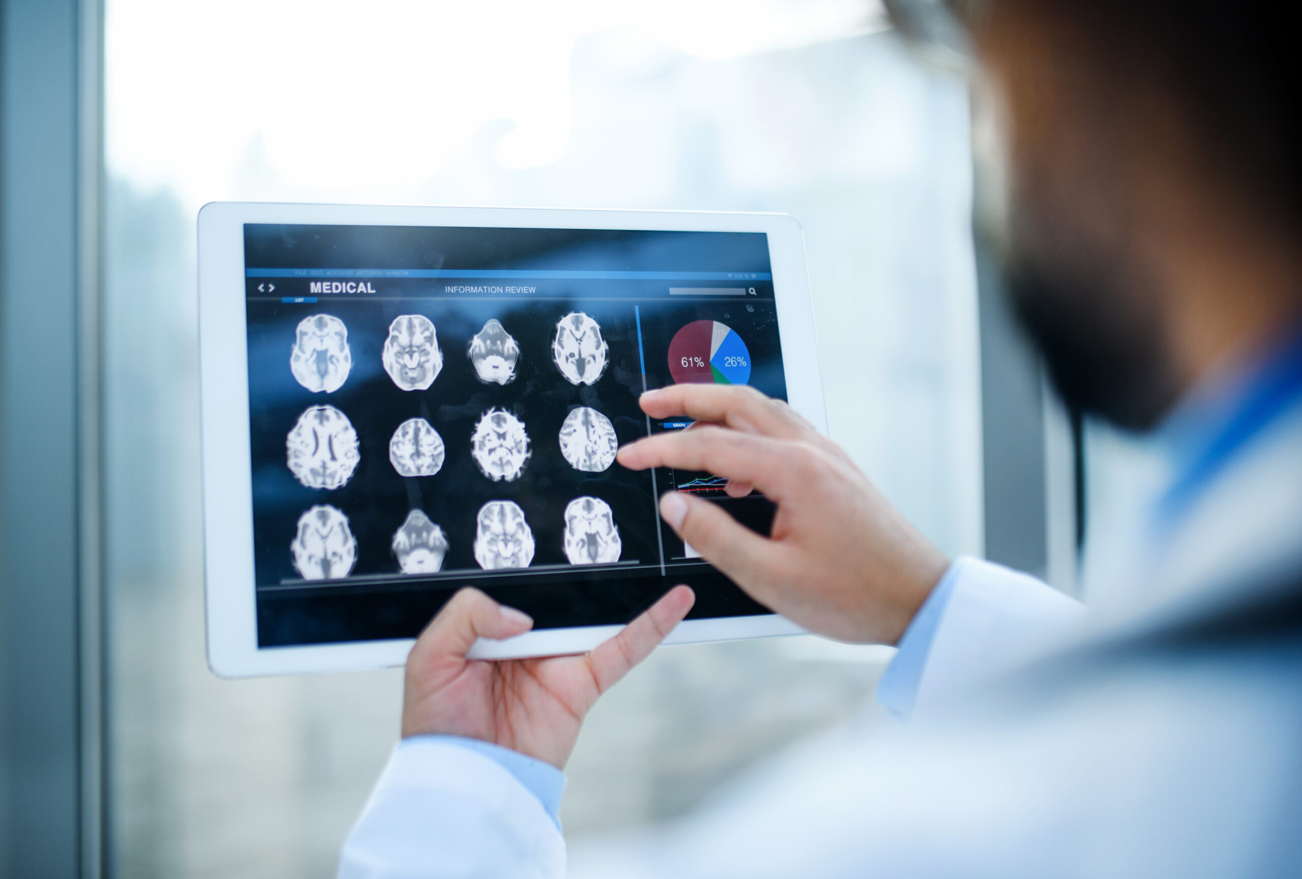 Irm cérébrale : un diagnostic précis du cerveau