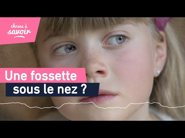 Pourquoi avons-nous une fossette sous le nez ?