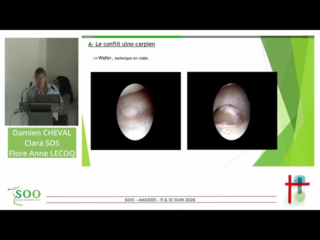 Que faire devant les douleurs ulnaires persistantes apr&egrave;s fracture du poignet ?